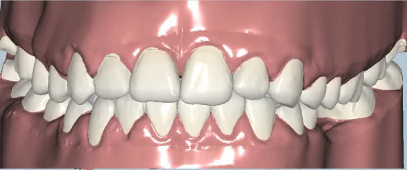 Визуализация зубного ряда